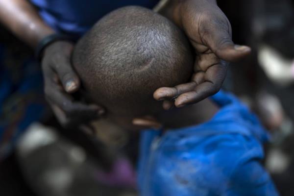 Lovely Benjamin holds the head of her 4-year-old son on June 4, 2023, to show the scar left from a machete chop he received during a gang attack in Port-au-Prince, Haiti. While she and her little boy survived the attack, gangs killed her partner and set his body on fire. They were left homeless.