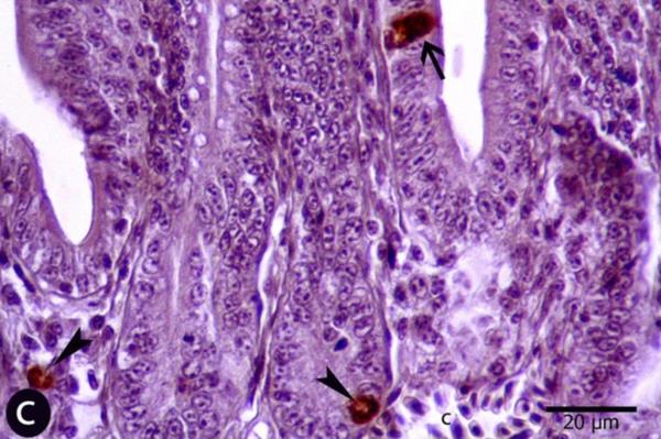 Low levels of seroto<em></em>nin - shown here in the gastrointestinal tract - might explain some symptoms of long COVID.