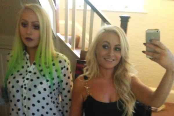 (Left to right) Twins Daisy and Dolly Simpson, 26, from the UK, before their surgeries.